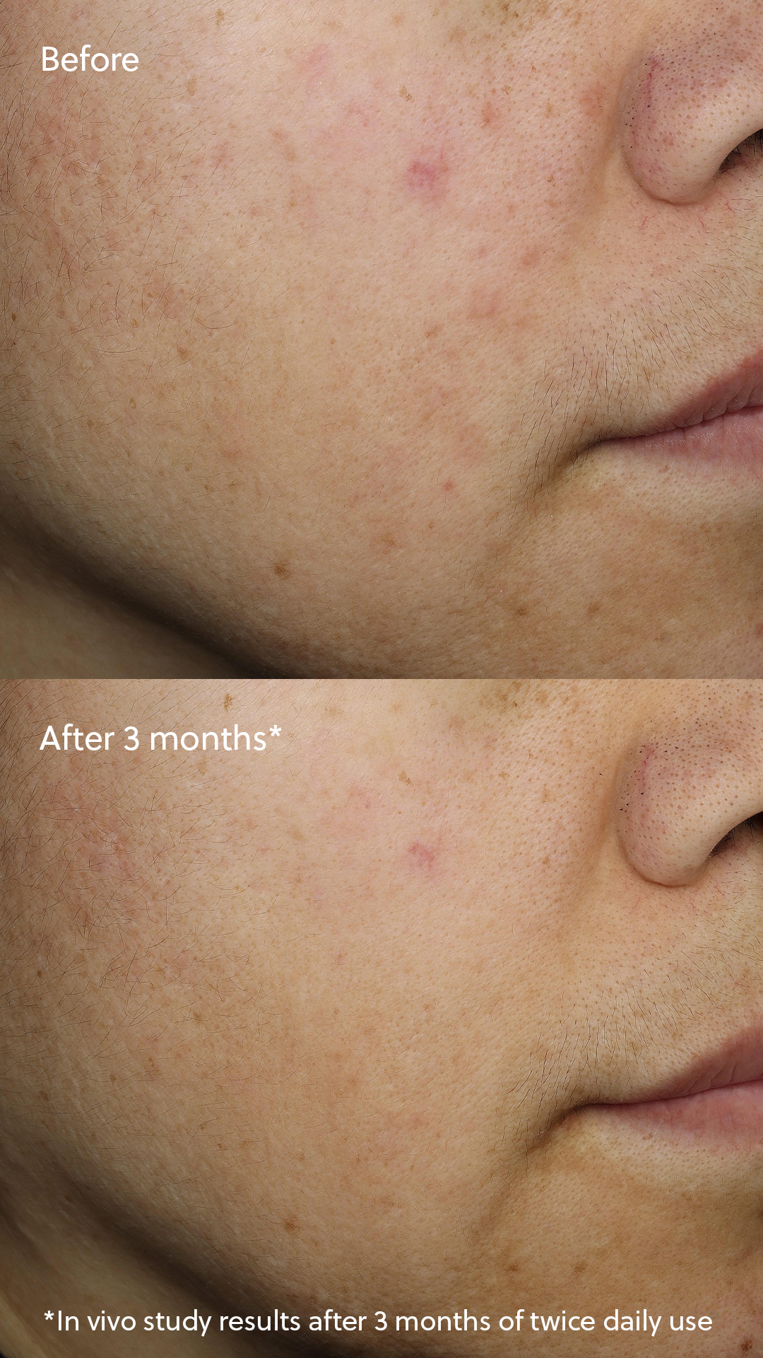 Vitamin C⁺ Serum - Image 5